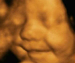 Baby dances, yawns --