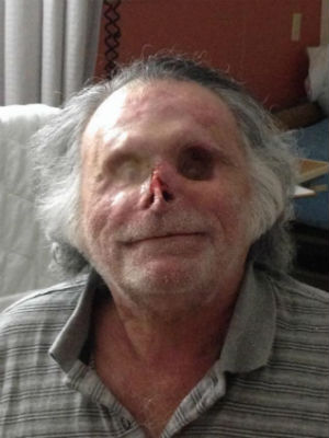 cannibal miami poppo ronald attack victim face after rudy his eugene off eaten who before man guy florida got eating