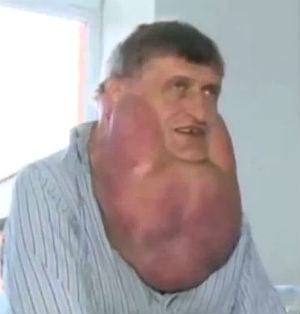 'Everybody was turning and looking at me,' Stefan Zoleik told journalists. 'It was very unpleasant. It also bothered me all the time when I moved my head.' 'Everybody was turning and looking at me,' Stefan Zoleik told journalists. 'It was very unpleasant. It also bothered me all the time when I moved my head.'