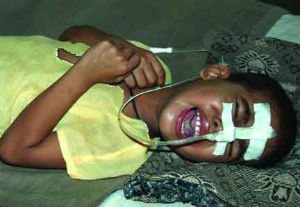 Japanese encephalitis is a disease caused by the mosquito-borne Japanese encephalitis virus. The Japanese encephalitis virus has an incubation perioid of 5 to 15 days. Japanese encephalitis is a disease caused by the mosquito-borne Japanese encephalitis virus. The Japanese encephalitis virus has an incubation perioid of 5 to 15 days.