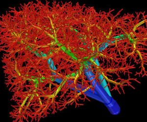 Utilizing a high-tech 'bio-printer,' researchers have fabricated a multitude of interconnected tiny fibers to serve as the mold for the artificial blood vessels. Utilizing a high-tech 'bio-printer,' researchers have fabricated a multitude of interconnected tiny fibers to serve as the mold for the artificial blood vessels.