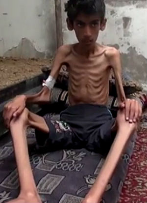 'God help us': Babies dying as humanitarian aid unable to reach starving populations (WARNING: GRAPHIC IMAGES)