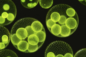 If temperature records, and thinning ice don't convince people the Arctic is warming, perhaps this humble algae will? If temperature records, and thinning ice don't convince people the Arctic is warming, perhaps this humble algae will?