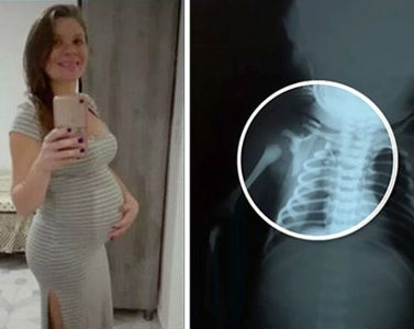 Claudineia dos Santos Melo was nine-months-pregnant when a bullet struck her baby. Claudineia dos Santos Melo was nine-months-pregnant when a bullet struck her baby.