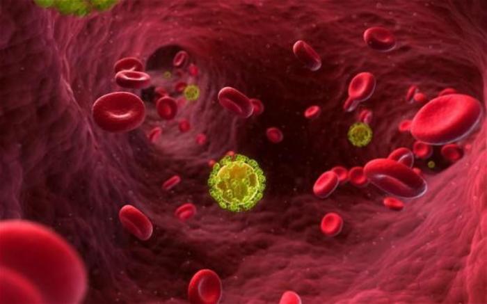 HIV virus seen in bloodstream. HIV virus seen in bloodstream.