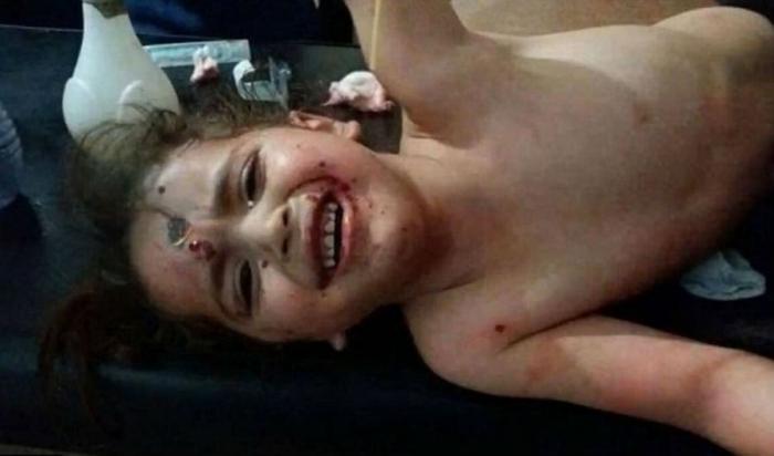 Children were bloodied and frightened. Children were bloodied and frightened.