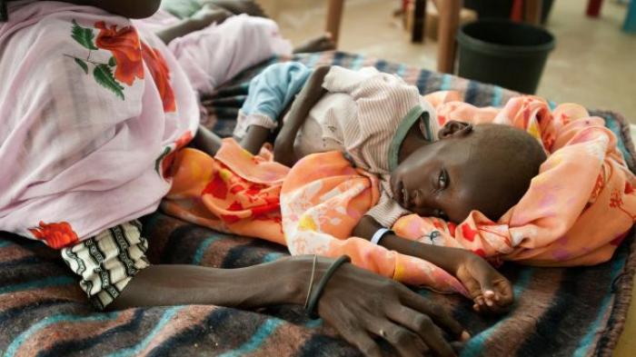 In some areas, the famine is already severe. Nearly 4 million people are at risk of starvation over In some areas, the famine is already severe. Nearly 4 million people are at risk of starvation over
