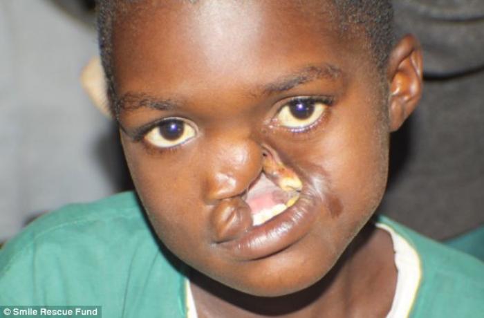 When she younger, Saline Atieno When she younger, Saline Atieno