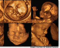 A baby is a human being, a person entirely distinct and separate from you and me. An individual. Not an extension of me, nor an extension of you. A brand-new man or woman.
Image of A baby is a human being, a person entirely distinct and separate from you and me. An individual. Not an extension of me, nor an extension of you. A brand-new man or woman.