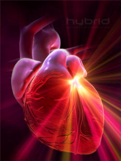 Image of