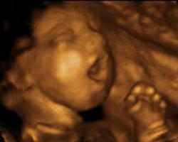 What a lasting blessing this piece could be to the Pro-Life community, and a powerful means of reaching indifferent hearts! Image of What a lasting blessing this piece could be to the Pro-Life community, and a powerful means of reaching indifferent hearts!
