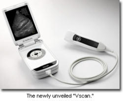 Vscan, an ultrasound machine about the size of a large flip phone. Image of Vscan, an ultrasound machine about the size of a large flip phone.