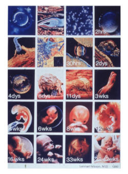 From the time that the ovum is fertilized, a new life is begun which is neither that of the father nor of the mother; it is rather the life of a new human being with his own growth. It would never be made human if it were not human already. To this perpetual evidence…modern genetic science brings valuable confirmation. It has demonstrated that, from the first instant, the program is fixed as to what this living being will be: a man, this individual man with his individual characteristics already determined.” (Declaration on Procured Abortion, 1974) Image of From the time that the ovum is fertilized, a new life is begun which is neither that of the father nor of the mother; it is rather the life of a new human being with his own growth. It would never be made human if it were not human already. To this perpetual evidence…modern genetic science brings valuable confirmation. It has demonstrated that, from the first instant, the program is fixed as to what this living being will be: a man, this individual man with his individual characteristics already determined.” (Declaration on Procured Abortion, 1974)