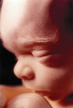 Image of