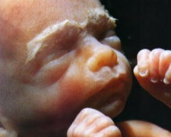'Personhood is a revolution of the pro-life movement,' stated Keith Mason, co-founder of Personhood USA. 'It challenges what's been done in the past, stimulates the movement's present, and eradicates the need for pro-life efforts in the future. Personhood is the best hope to end abortion in America.' Image of 'Personhood is a revolution of the pro-life movement,' stated Keith Mason, co-founder of Personhood USA. 'It challenges what's been done in the past, stimulates the movement's present, and eradicates the need for pro-life efforts in the future. Personhood is the best hope to end abortion in America.'