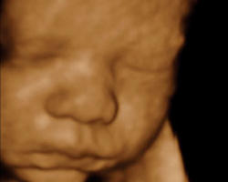 '...the fetus is another life in a woman and loss of the fetus is actually loss of a child in the offing' Justice Midha stated. Image of '...the fetus is another life in a woman and loss of the fetus is actually loss of a child in the offing' Justice Midha stated.