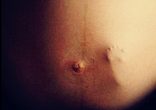 Obama refused even to address the abortion issue. Image of Obama refused even to address the abortion issue.