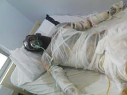 Arshed Masih, 38, is still fighting for his life in Holy Family Hospital. Image of Arshed Masih, 38, is still fighting for his life in Holy Family Hospital.
