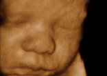 Surgeons true to their oath to do no harm now use this technology to help them operate on these little girls and boys while they are growing in the first home of their mother's womb. Yet, others use the same technology to assist them in killing them.
Image of Surgeons true to their oath to do no harm now use this technology to help them operate on these little girls and boys while they are growing in the first home of their mother's womb. Yet, others use the same technology to assist them in killing them.