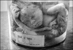 abortion botched frozen gruesome jars catholic inside crumbles empire four following state