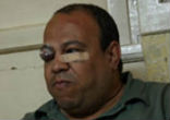 The Islamic attack on St. Mina Church in Cairo sent a piece of glass into the eye of Ramses Roushdy. Photo provided by Compass News Service. Image of The Islamic attack on St. Mina Church in Cairo sent a piece of glass into the eye of Ramses Roushdy. Photo provided by Compass News Service.