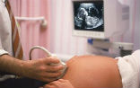 Sonograms are better than ultrasounds for showing mothers the reality of the baby they carry, and may be choosing to abort. Image of Sonograms are better than ultrasounds for showing mothers the reality of the baby they carry, and may be choosing to abort.