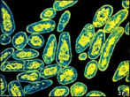TB infects nearly 1/3 people worldwide and is one of the top 10 leading causes of death. Image of TB infects nearly 1/3 people worldwide and is one of the top 10 leading causes of death.