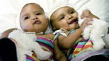 Ritag and Rital are recovering in a London hospital. Image of Ritag and Rital are recovering in a London hospital.