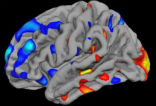 Research suggests that brain scans may be used as an early indicator of autism. Image of Research suggests that brain scans may be used as an early indicator of autism.