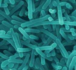 Deadly listeria outbreak spreading - Health & Wellness - News
