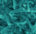 Listeria bacteria as imaged under a microscope. Image of Listeria bacteria as imaged under a microscope.