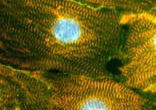 Adult Stem Cells hold great promise and research in this field is encouraged and supported by the Catholic Church Image of Adult Stem Cells hold great promise and research in this field is encouraged and supported by the Catholic Church