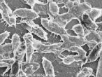 Flesh eating bacteria as viewed under an electron microscope. Image of Flesh eating bacteria as viewed under an electron microscope.