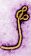 A famous image of the Ebola virus. There are multiple strains of the Ebola virus which occasionally infect victims in equatorial Africa. Image of A famous image of the Ebola virus. There are multiple strains of the Ebola virus which occasionally infect victims in equatorial Africa.