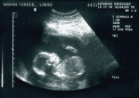Image of
