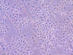 Human cells in a petri dish. If this can be done so easily, why hasn't it been done sooner for cancer? Pictured: two intestinal cancer cells. Image of Human cells in a petri dish. If this can be done so easily, why hasn't it been done sooner for cancer? Pictured: two intestinal cancer cells.