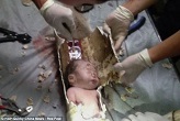 The Chinese baby boy was recued from a sewer pipe. Image of The Chinese baby boy was recued from a sewer pipe.