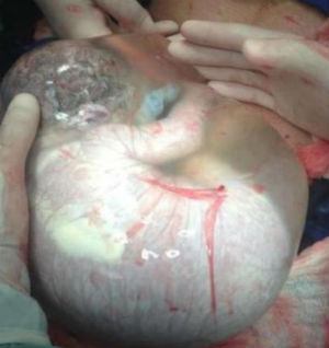 Filled with clear, pale fluid the unborn baby floats and moves in the amniotic sac. The fluid cushions the baby from bumps and injury, as well as providing them with fluids that they can breathe and swallow. Filled with clear, pale fluid the unborn baby floats and moves in the amniotic sac. The fluid cushions the baby from bumps and injury, as well as providing them with fluids that they can breathe and swallow.