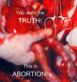 Abortion is nothing more than murder of our unborn children. Abortion is nothing more than murder of our unborn children.