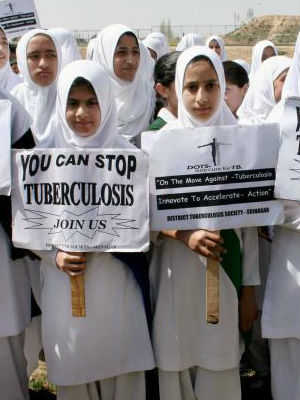'A huge proportion (of children) are suffering and dying from TB unnecessarily,' Helen Jenkins of Brigham and Women's Hospital's Division of Global Health Equity says. 'A huge proportion (of children) are suffering and dying from TB unnecessarily,' Helen Jenkins of Brigham and Women's Hospital's Division of Global Health Equity says.