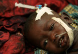 A malaria infected child receiving treatment. Image of A malaria infected child receiving treatment.