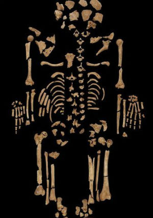 There have been some previous hints of the disease in archaeological records. A U.S. researcher published details of a 120,000-year-old fossilized Neanderthal rib that showed indications of a bone tumor. There have been some previous hints of the disease in archaeological records. A U.S. researcher published details of a 120,000-year-old fossilized Neanderthal rib that showed indications of a bone tumor.