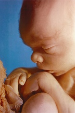 We all know they are all members of our human family. Our 4D sonogram technology has made it possible to take baby´s first picture and send it as a birth announcement or place it on a Face Book or My Space page. We send it through our Social Networks.
We marvel at the image of those little babies at the early stages of what is a lifetime of development for every human being. We then use that same technology to direct the weapons of warfare which will dismember them in the womb and kill them. We do not want to see those pictures. Image of We all know they are all members of our human family. Our 4D sonogram technology has made it possible to take baby´s first picture and send it as a birth announcement or place it on a Face Book or My Space page. We send it through our Social Networks.
We marvel at the image of those little babies at the early stages of what is a lifetime of development for every human being. We then use that same technology to direct the weapons of warfare which will dismember them in the womb and kill them. We do not want to see those pictures.