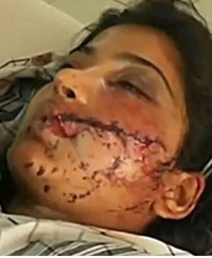 Saba Maqsood had married a neighbor five days before her attack, against the wishes of her family. 'It is an honor-related incident,' Ali Akbar, a local police officer says. Saba Maqsood had married a neighbor five days before her attack, against the wishes of her family. 'It is an honor-related incident,' Ali Akbar, a local police officer says.