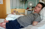 A British man has lost all four of his limbs after a common cold developed into a rare flesh-eating bacteria. Image of A British man has lost all four of his limbs after a common cold developed into a rare flesh-eating bacteria.