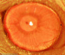 Adult stem cells have allowed scientist to regrow cornea tissue which could help cure blindness. Image of Adult stem cells have allowed scientist to regrow cornea tissue which could help cure blindness.