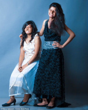 First published on Facebook page run by Stop Acid Attacks, an organization raising awareness about the plight of acid attack victims, the photos have since been featured extensively across the world. First published on Facebook page run by Stop Acid Attacks, an organization raising awareness about the plight of acid attack victims, the photos have since been featured extensively across the world.
