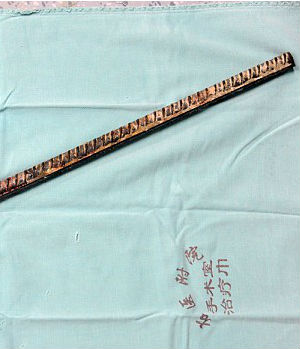 Luck was with a 50-year-old Chinese man - an inch thick metal spear went straight though his head. The object narrowly missed his brain and left eye socket, and he's expected to recover fully. Luck was with a 50-year-old Chinese man - an inch thick metal spear went straight though his head. The object narrowly missed his brain and left eye socket, and he's expected to recover fully.