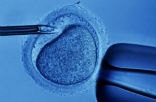 In vitro fertilization requires the conception of several children in a test-tube to maximize the outcome of success, but then the unwanted children are destroyed before being implanted into their mother's womb. Image of In vitro fertilization requires the conception of several children in a test-tube to maximize the outcome of success, but then the unwanted children are destroyed before being implanted into their mother's womb.