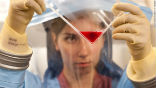 A potential serum from the blood of infected and recovered Ebola patients could provide the key to halting the ongoing outbreak. Image of A potential serum from the blood of infected and recovered Ebola patients could provide the key to halting the ongoing outbreak.